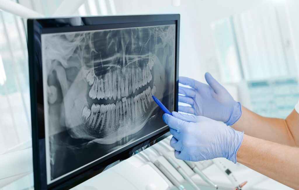 Hands doctor dentist in gloves show the teeth on x-ray on digital screen in dental clinic on light background with medical equipment. Smile healthy teeth concept, close up