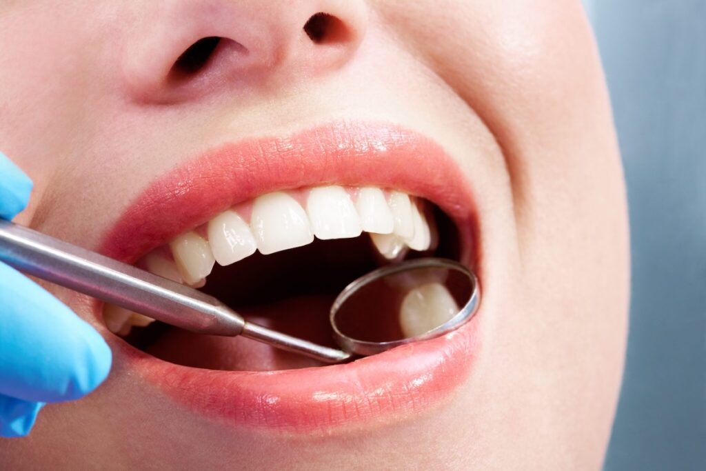 teeth