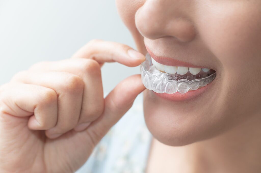 dental-appliance